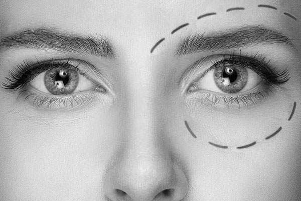 Yorgun bakışlara “göz altı ışık dolgusu” ile veda edin